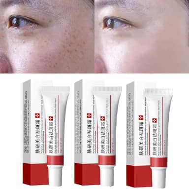 Creme de sarda, creme de tratamento de remoção de cicatrizes de acne, creme de remoção de pigmentação para o rosto, creme de sarda de clareamento remove creme de melasma, adequado para todos os tipos de pele (3 peças)