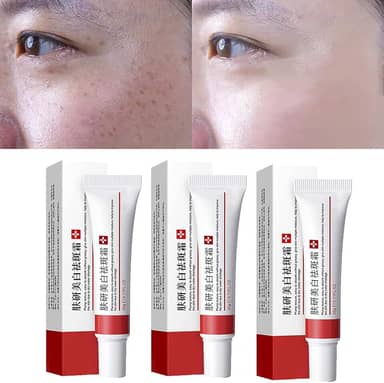 Creme de sarda, creme de tratamento de remoção de cicatrizes de acne, creme de remoção de pigmentação para o rosto, creme de sarda de clareamento remove creme de melasma, adequado para todos os tipos de pele (3 peças)